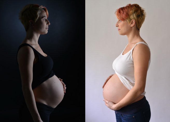 הריון שחור ולבן
